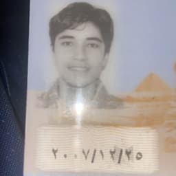 تشريد المحروق 