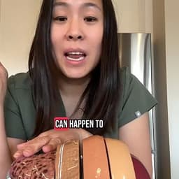 7.1肝病女医生-肝脏-英语