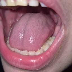 La bestia debe morir